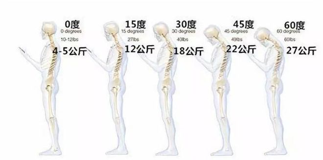 为什么你的脖子总是咔咔响！(图2)