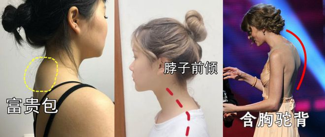为什么你的脖子总是咔咔响！(图4)